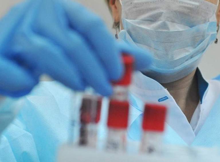 В Краснодарском крае подтверждено 48 новых случаев коронавируса